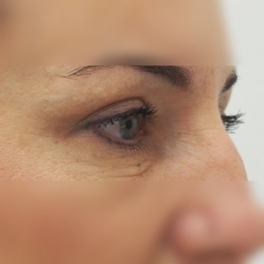 Image after