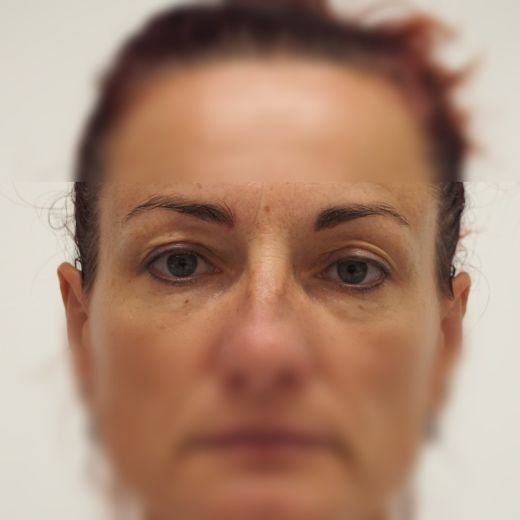 Image before