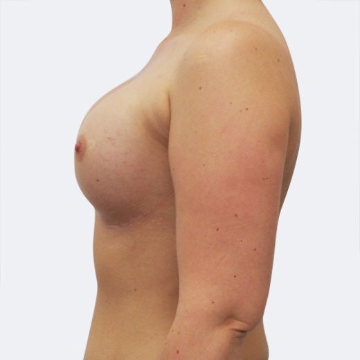 Image after