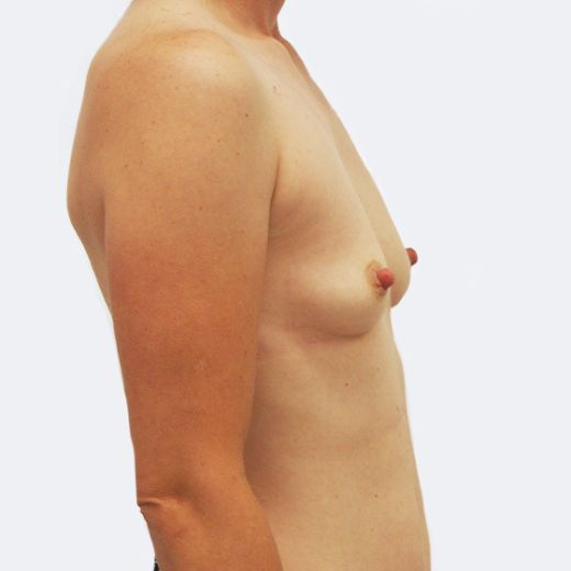 Image before