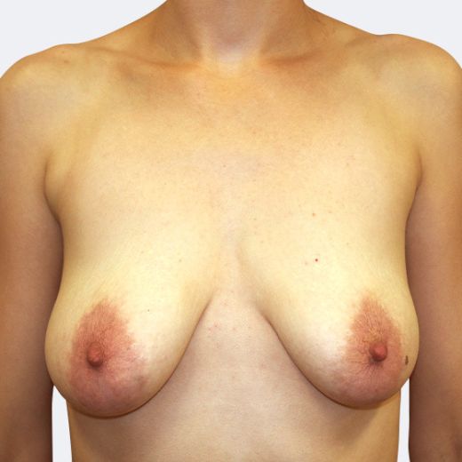 Image before