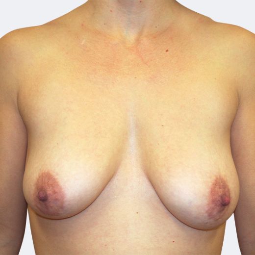 Image before