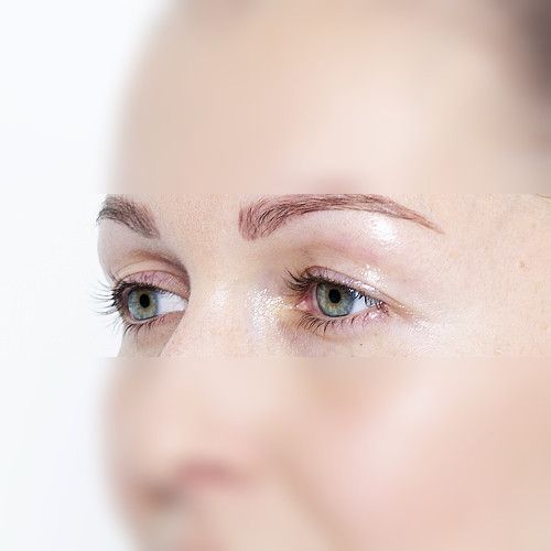 Image before