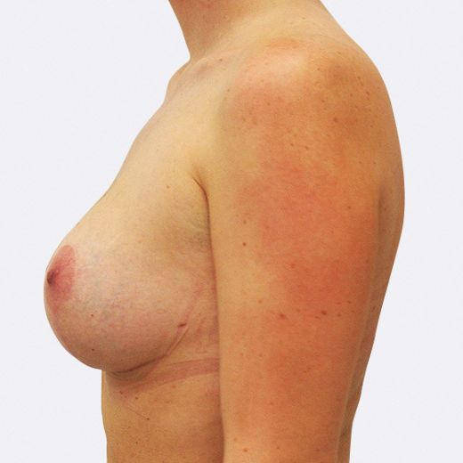 Image after