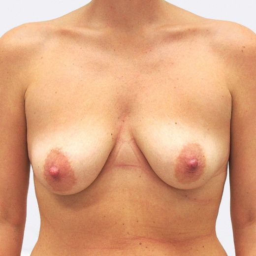 Image before