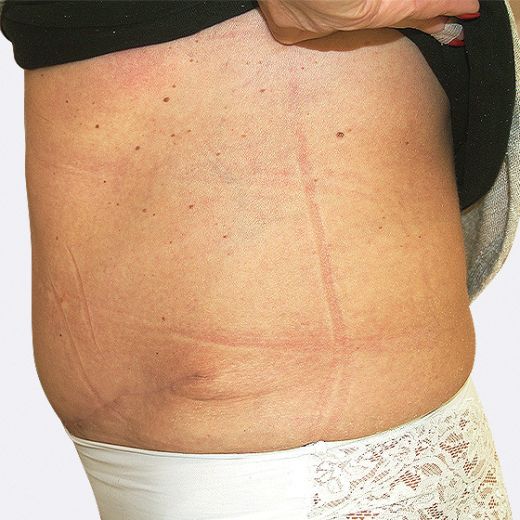 Image after