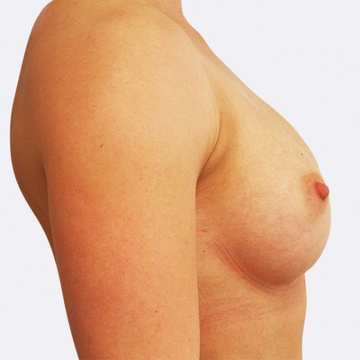 Image after