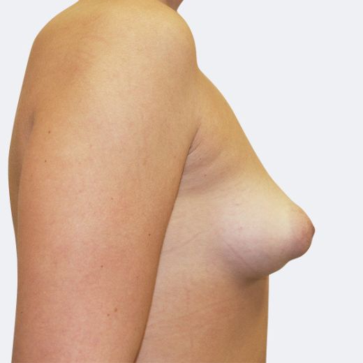 Image before