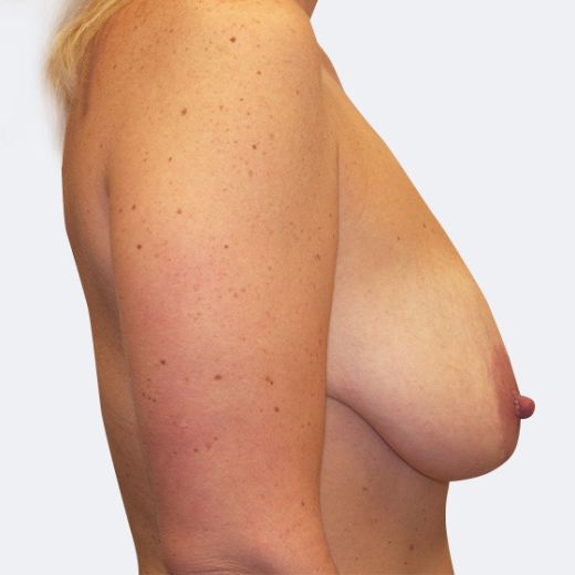 Image before