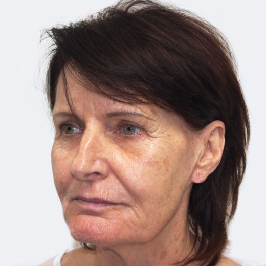 Image before