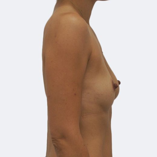 Image before