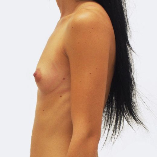Image before