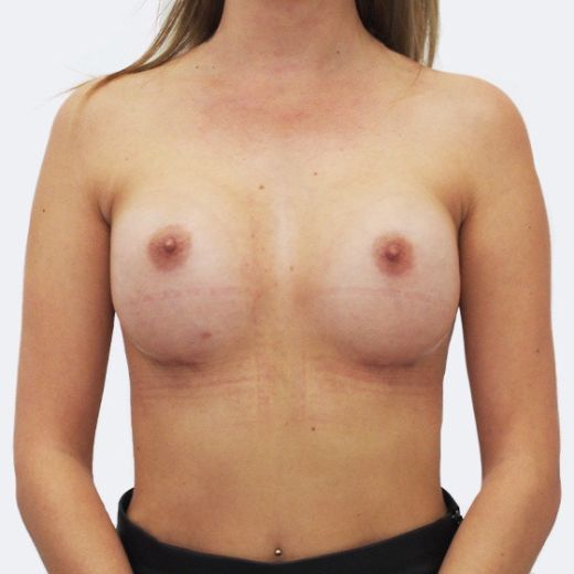 Image after