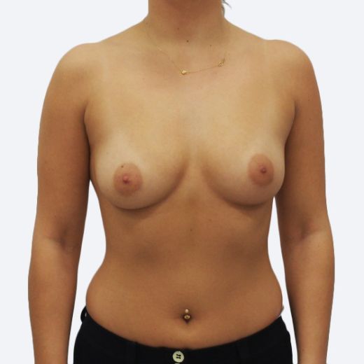 Image before