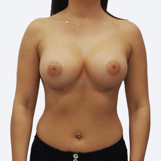 Image after