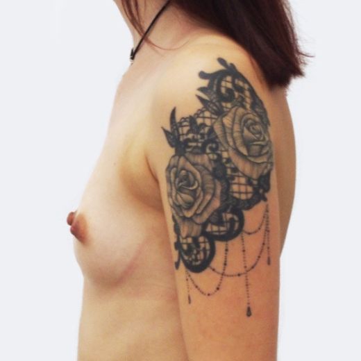 Image before