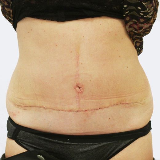 Image after