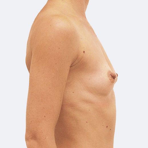 Image before