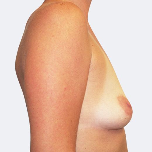 Image before