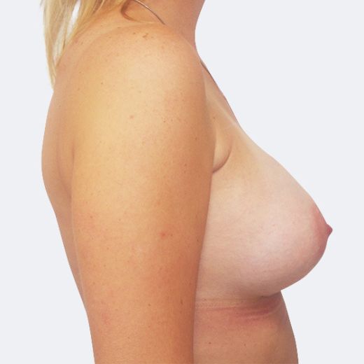 Image after