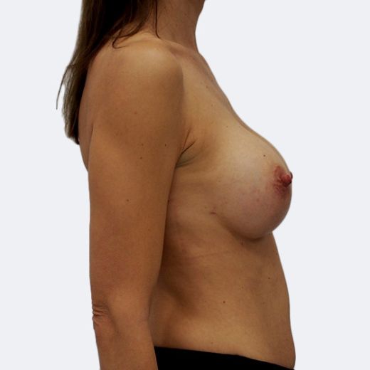 Image after