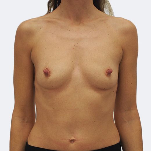 Image before