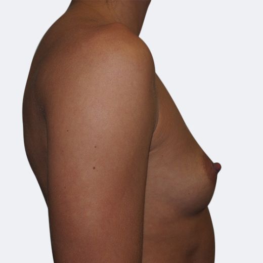 Image before