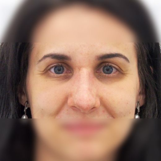 Image after