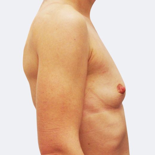 Image before