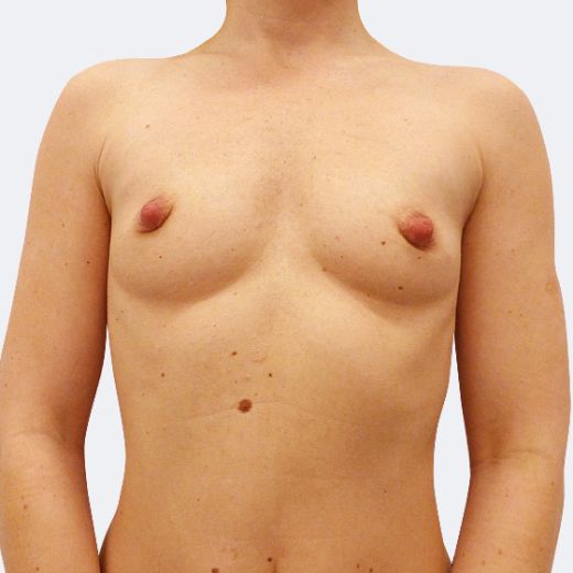 Image before