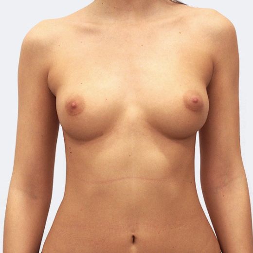 Image before