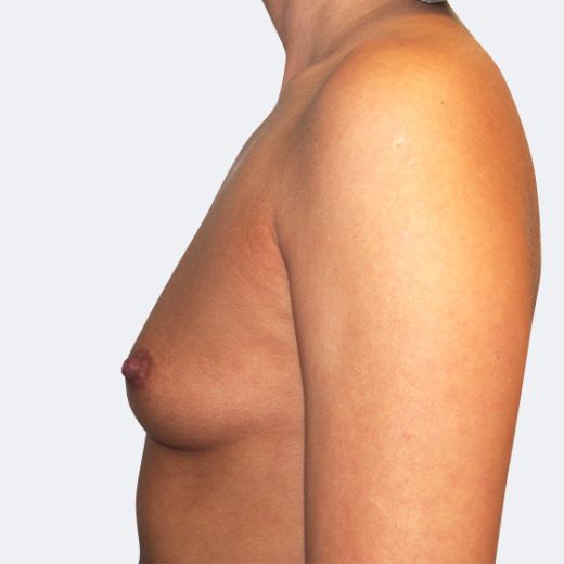 Image before