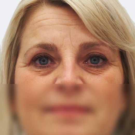 Image after
