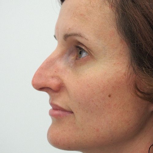 Image before