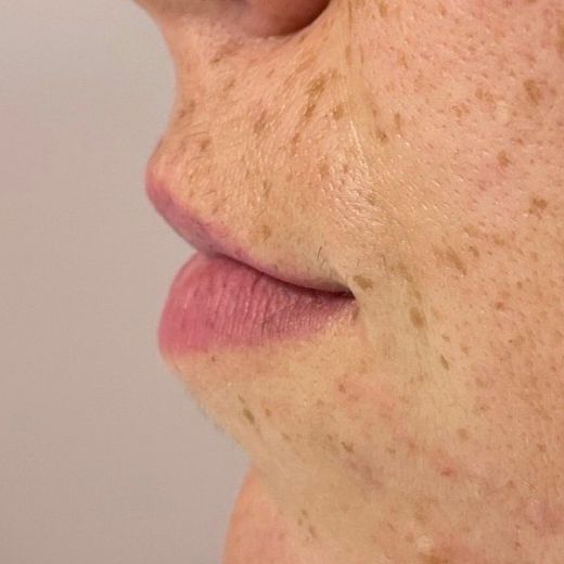Image before