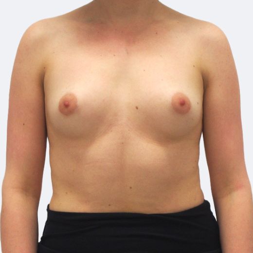 Image before