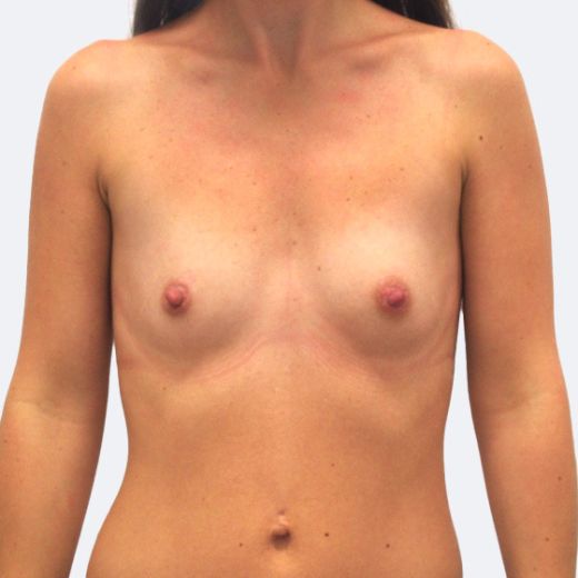 Image before