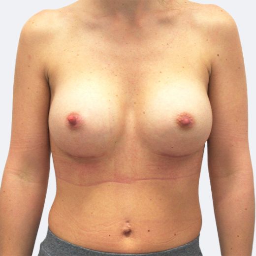Image after