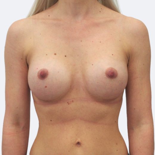 Image after