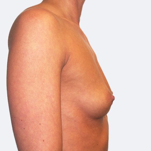 Image before