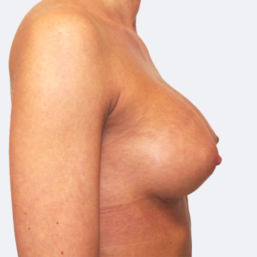 Image after