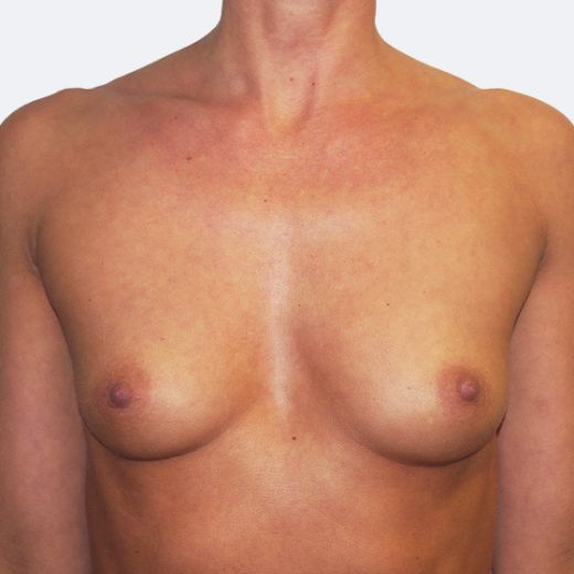 Image before