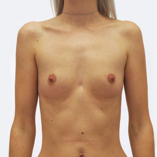 Image before