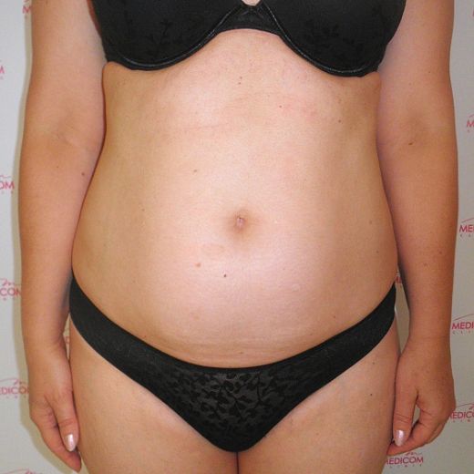 Image before