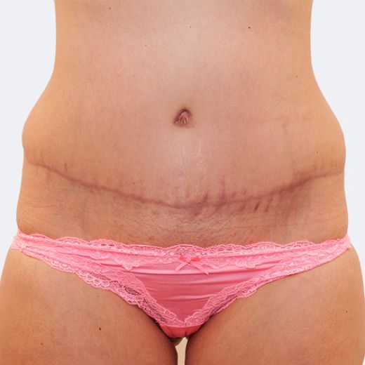 Image after
