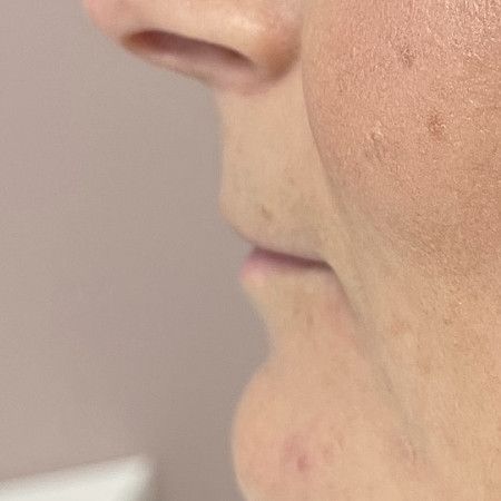 Image before