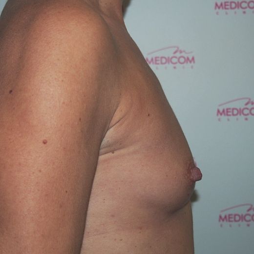 Image before