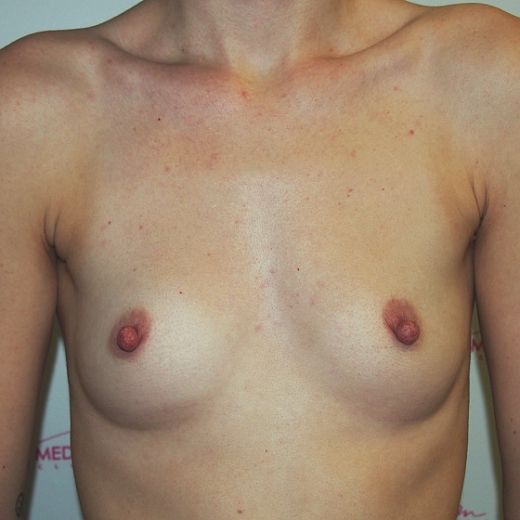 Image before