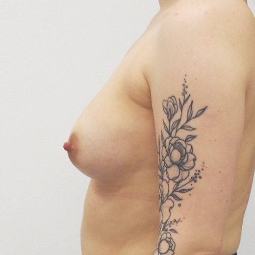 Image before