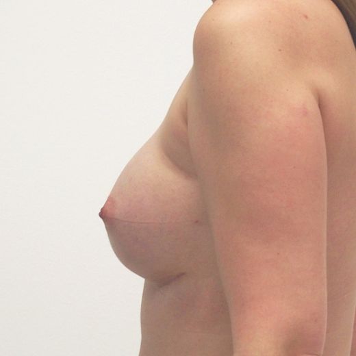 Image after